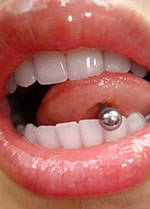 Tongue Rings and Oral Health