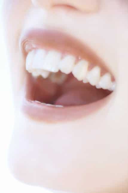 Four Reasons to Replace Missing Teeth