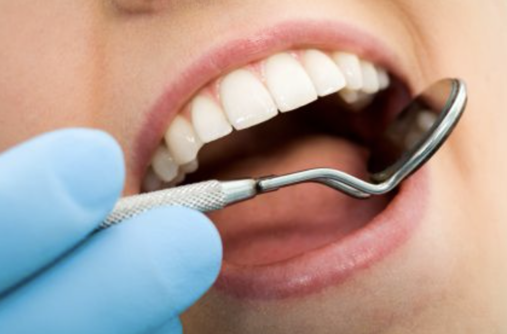 Dental Cleaning